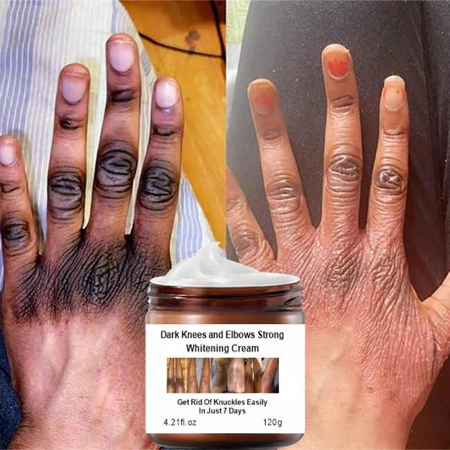 Mooyam - Whitening Cream (Original)